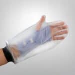 שרוול לגבס קצר יד